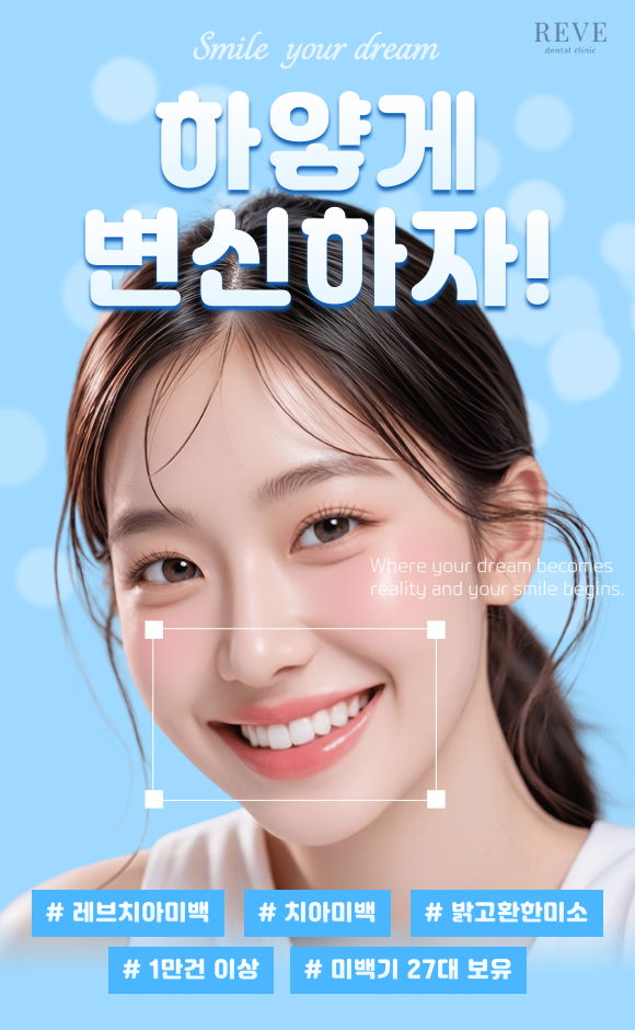 원데이 치아미백